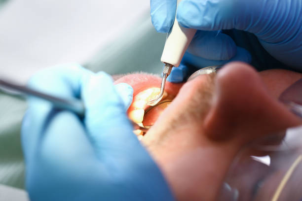 Best Emergency TMJ Treatment in Leonville, LA